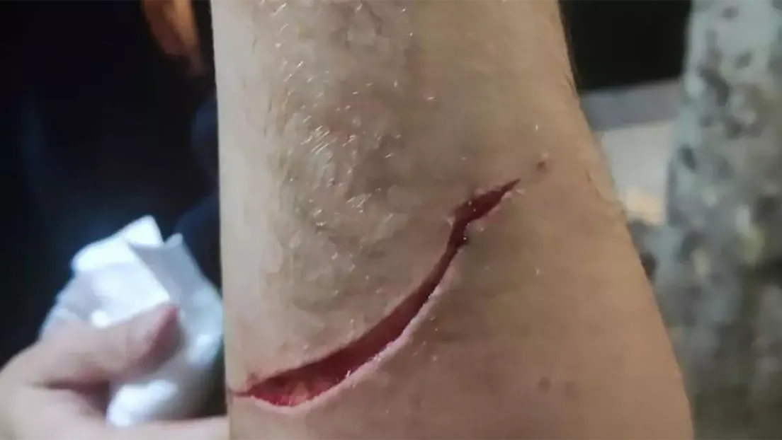 Apuñalan a un agente de los Mossos fuera de servicio evitando un robo en Barcelona