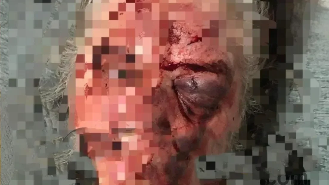 Un magrebí le da una brutal paliza a un matrimonio de ancianos y hiere a varios policías tras robar en un estanco en Jaén