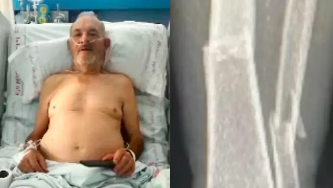 La Guardia Civil busca a tres magrebíes por agredir a un hombre mayor de 73 años en Murcia: «Solo dije que no dañaran coches aparcados»