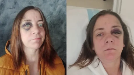 Unos individuos agreden brutalmente a una mujer en Badalona y le roban sus pertenencias: «Por la voz, son marroquíes seguro» - abril 2025