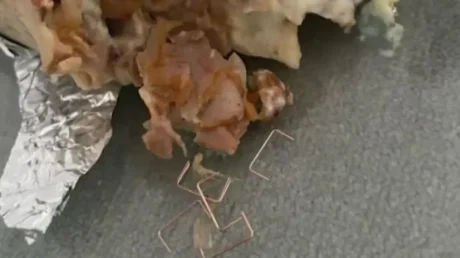 Ingresan a una menor de 13 años en Badajoz tras comer un kebab con grapas metálicas en su interior - mayo 2025