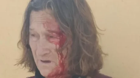 Dos menores marroquíes asaltan violentamente a una anciana en la entrada de su hogar en El Ejido (Almería) con el objetivo de robarle el bolso - mayo 2025