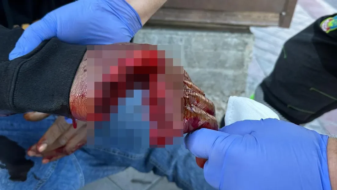 Un menor marroquí le amputa la mano de un machetazo a otro de origen subsahariano en un centro de acogida de Madrid
