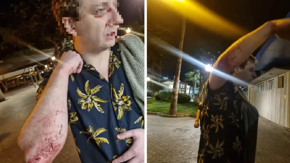 Tres magrebíes agreden y roban a un turista inglés en Las Palmas de Gran Canaria