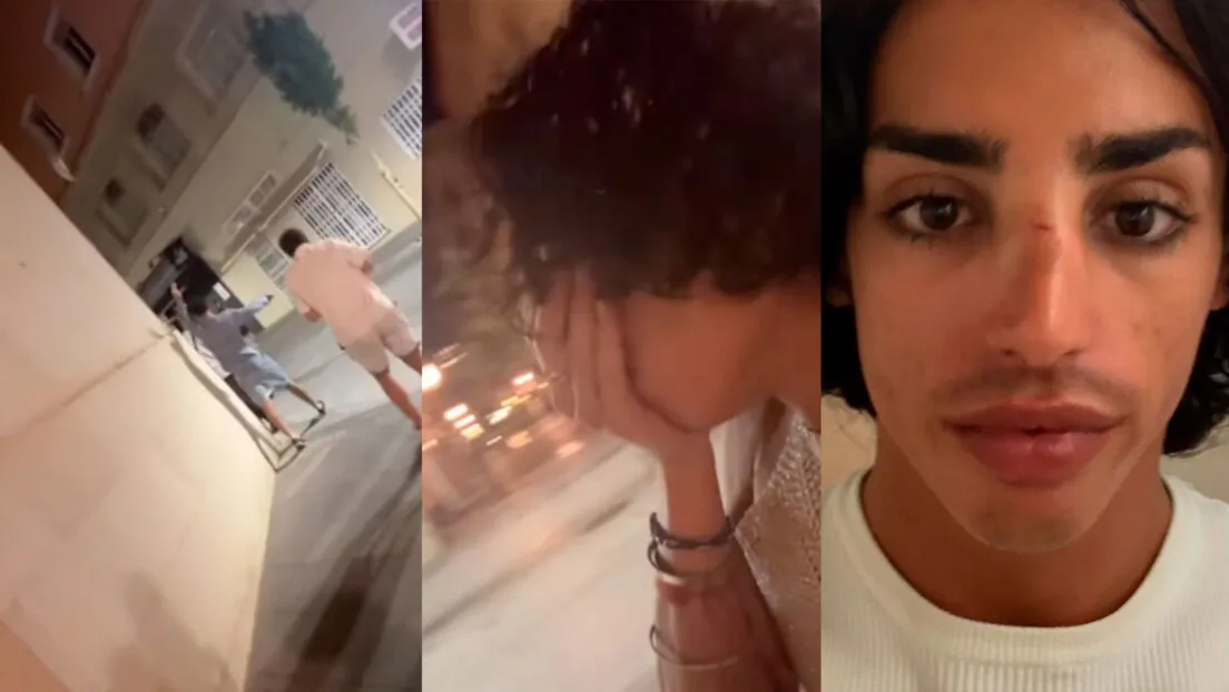Detenido en Alicante un menor marroquí de 14 años por agresión y delito de odio a un joven homosexual que recibió un botellazo en la nariz