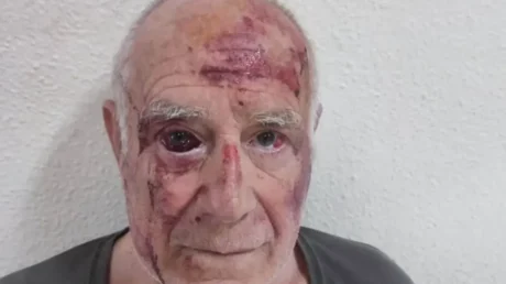 Un magrebí propina una brutal paliza a un hombre de 68 años en Torre Pacheco mientras otros dos individuos observan y lo graban - julio 2025