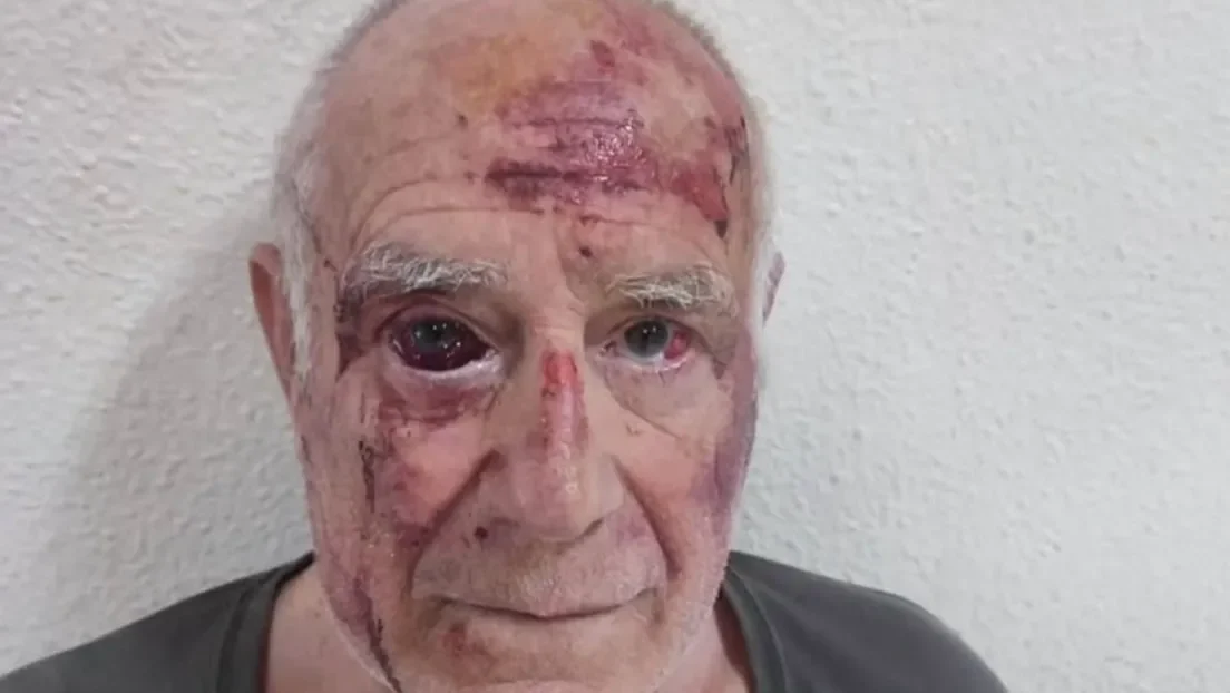Un magrebí propina una brutal paliza a un hombre de 68 años en Torre Pacheco mientras otros dos individuos observan y lo graban