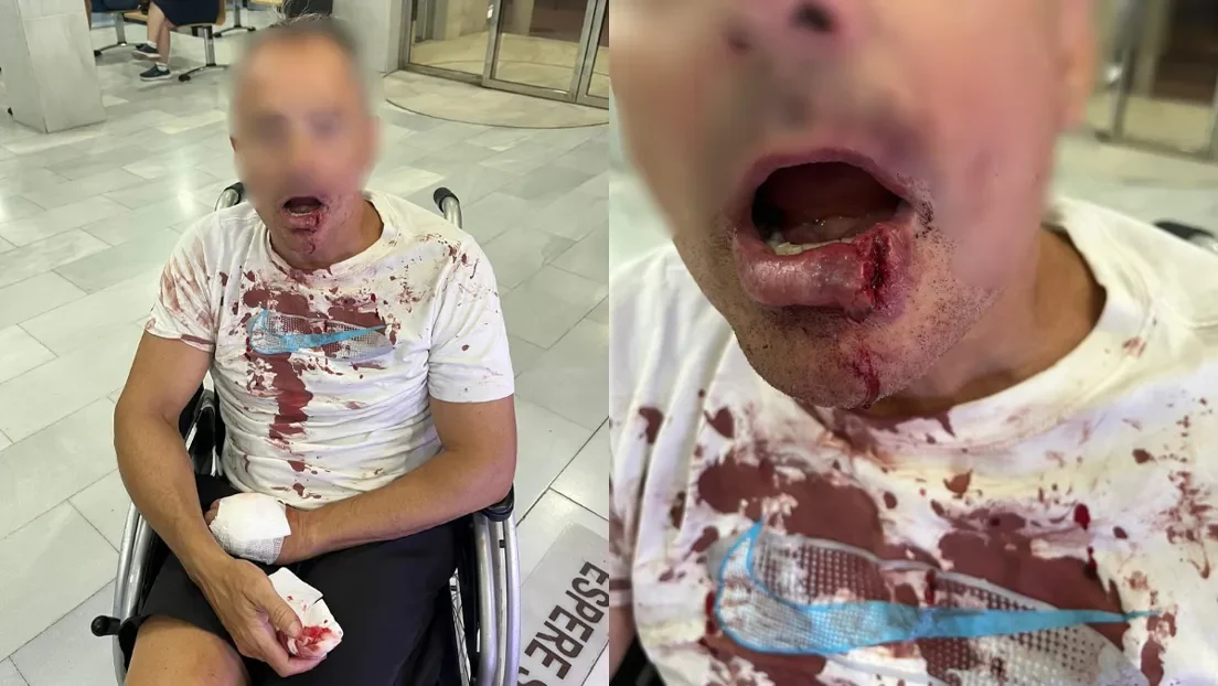La horda de magrebíes de Torre Pacheco le reventó el labio con un adoquín a un hombre que paseaba con su mujer